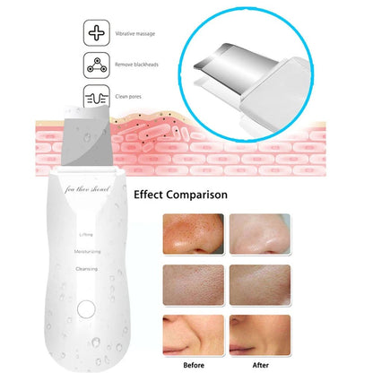 PureGlow Pore Purifier - mucaccessory